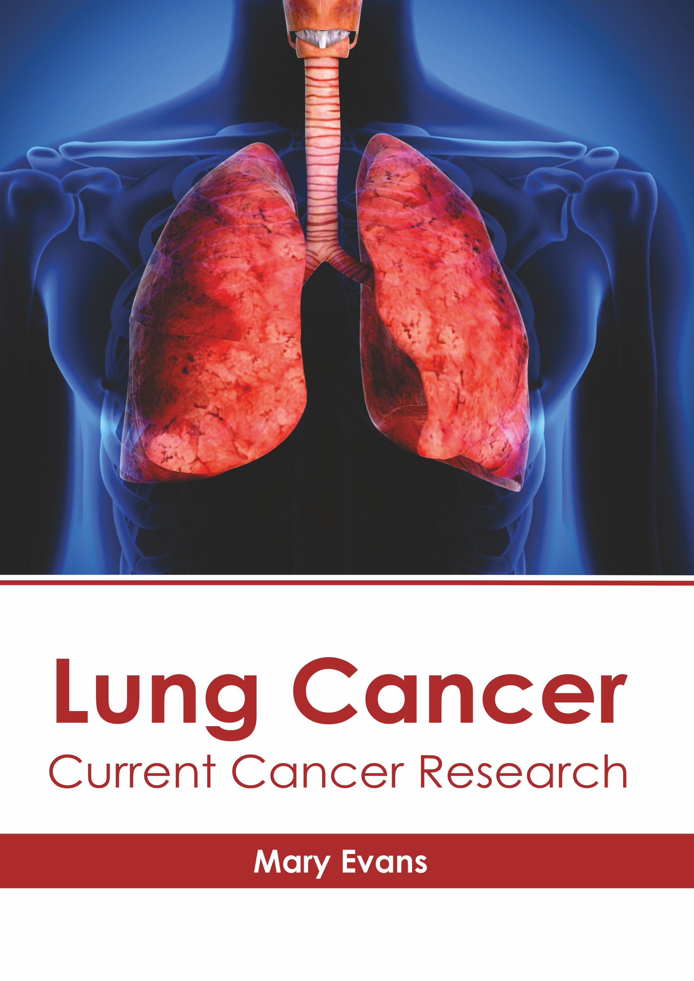 
exclusive-publishers/american-medical-publishers/lung-cancer-current-cancer-research-9781639273607