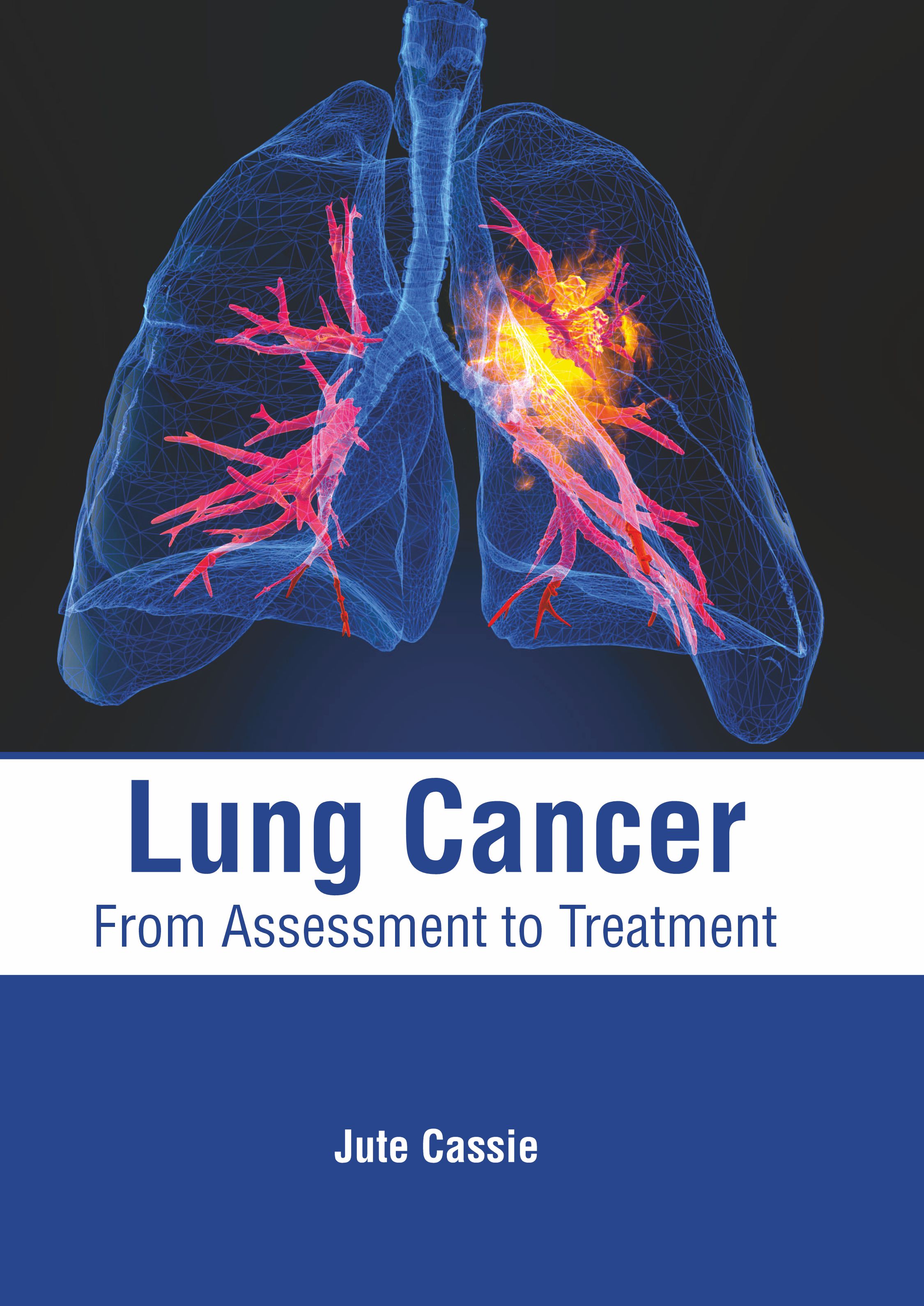 LUNG CANCER: FROM ASSESSMENT TO TREATMENT