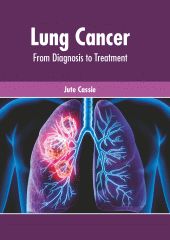 LUNG CANCER: FROM DIAGNOSIS TO TREATMENT