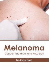 MELANOMA: CANCER TREATMENT AND RESEARCH