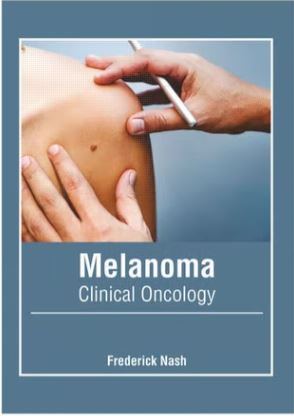 MELANOMA: CLINICAL ONCOLOGY