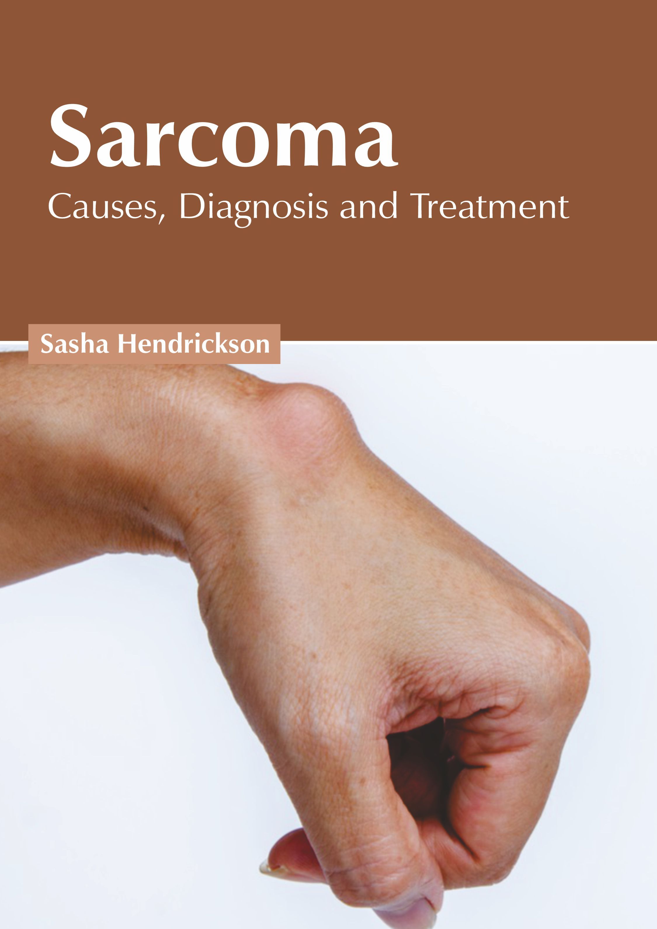 SARCOMA: CAUSES, DIAGNOSIS AND TREATMENT