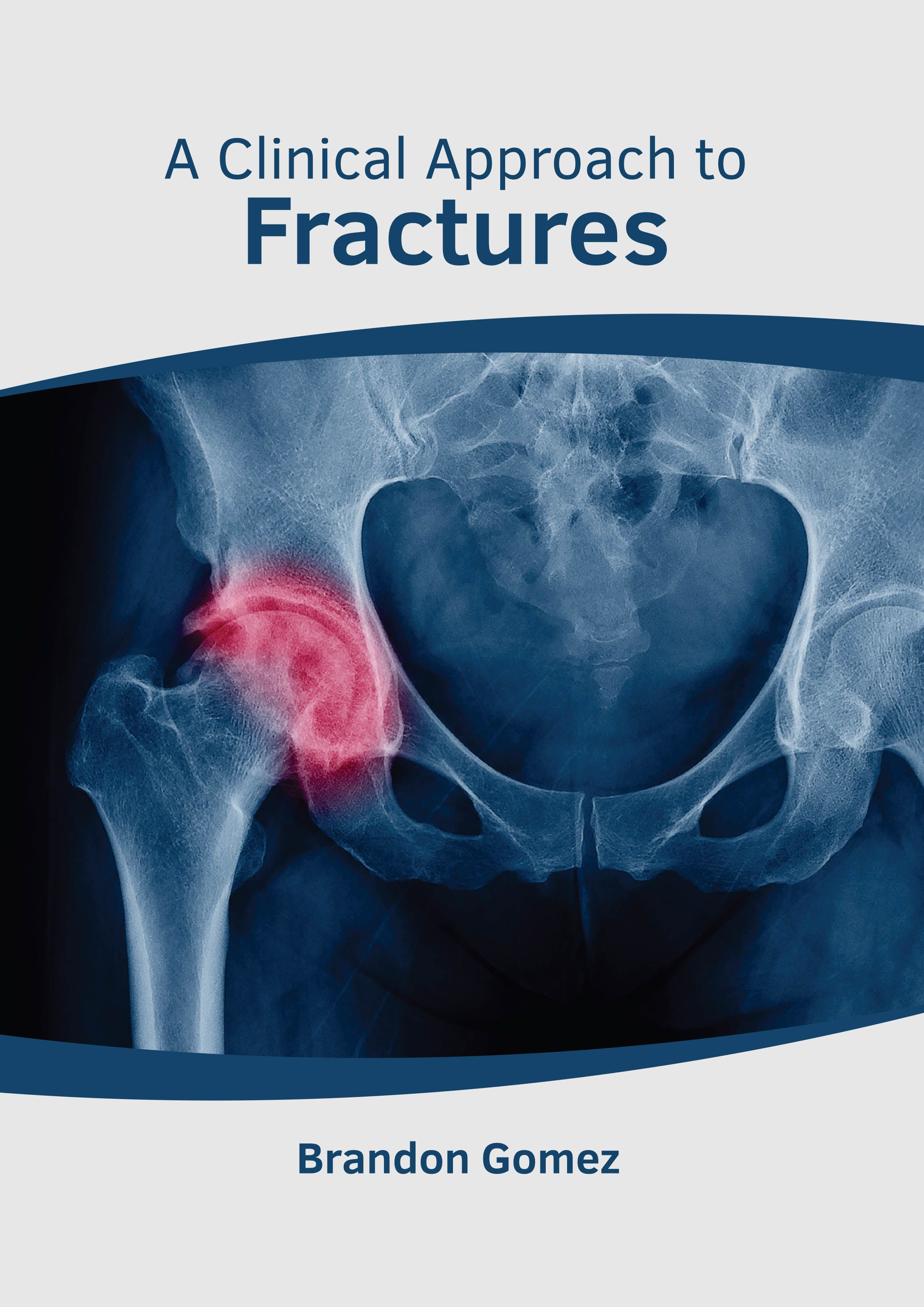 A CLINICAL APPROACH TO FRACTURES- ISBN: 9781639273881