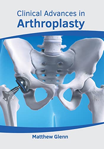 
exclusive-publishers/american-medical-publishers/clinical-advances-in-arthroplasty-9781639273911