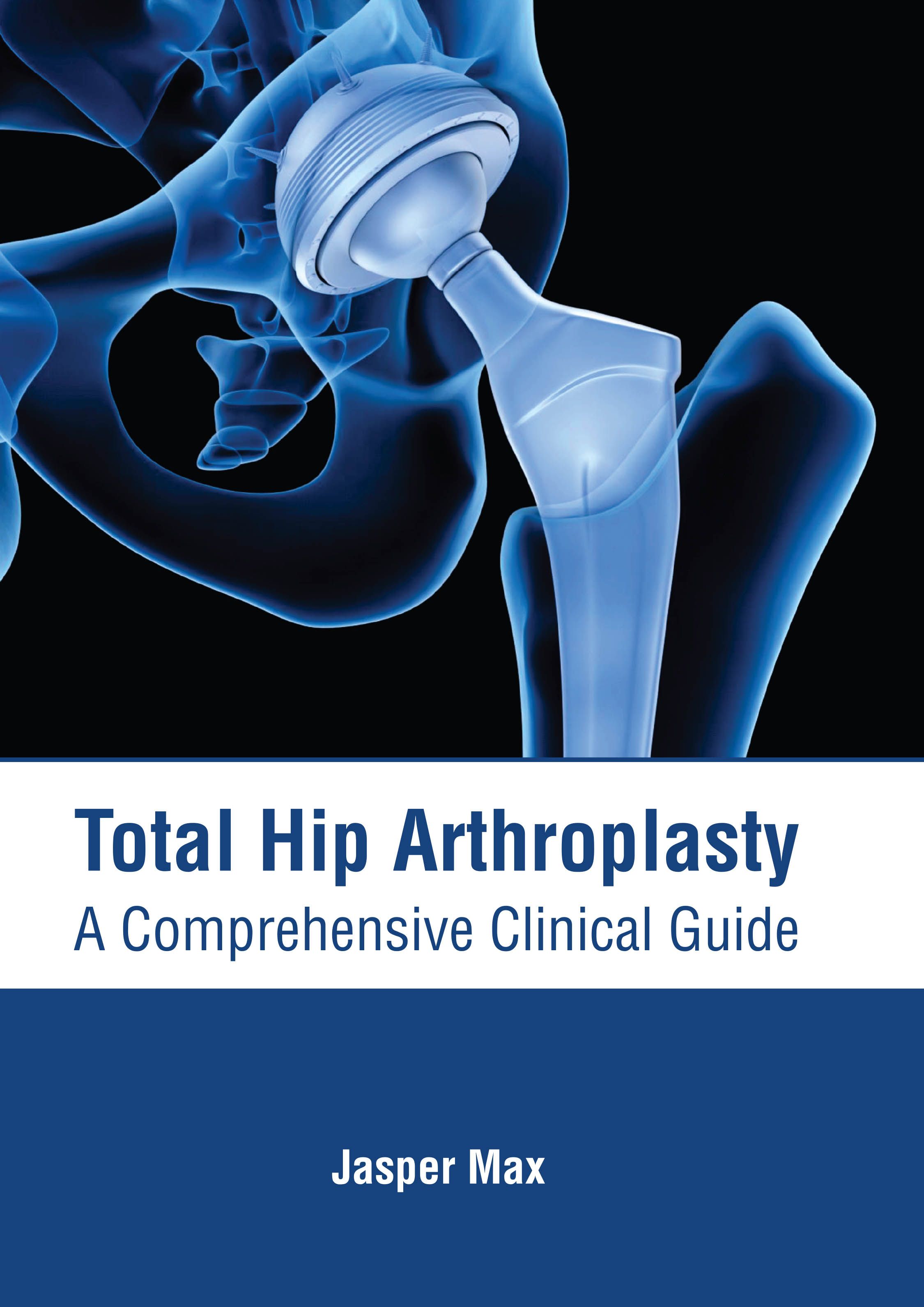 TOTAL HIP ARTHROPLASTY: A COMPREHENSIVE CLINICAL GUIDE | ISBN: 9781639274048