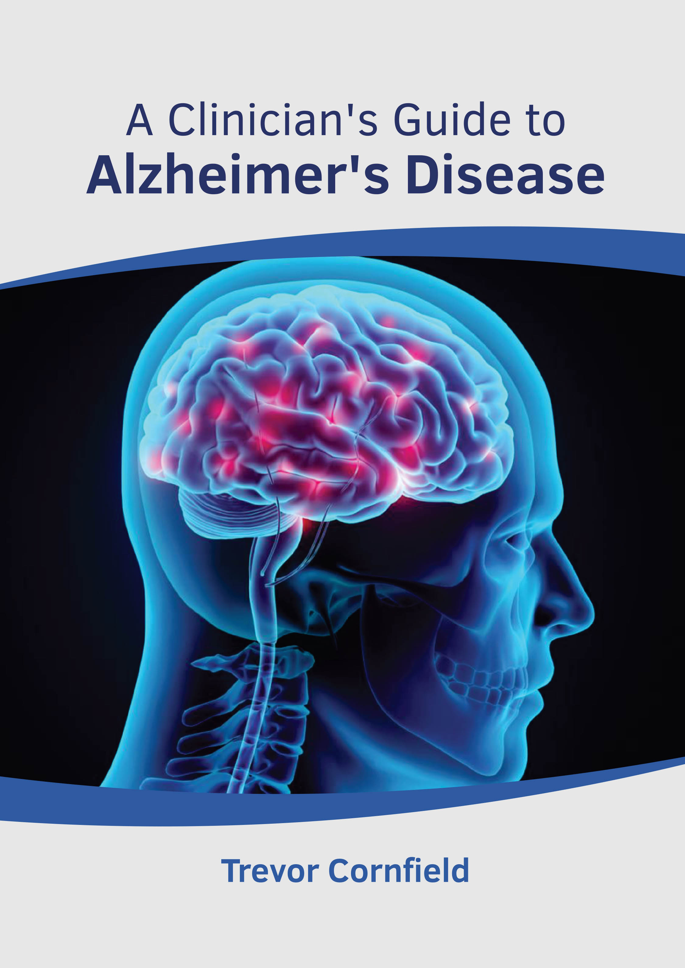 A CLINICIAN'S GUIDE TO ALZHEIMER'S DISEASE | ISBN: 9781639274321