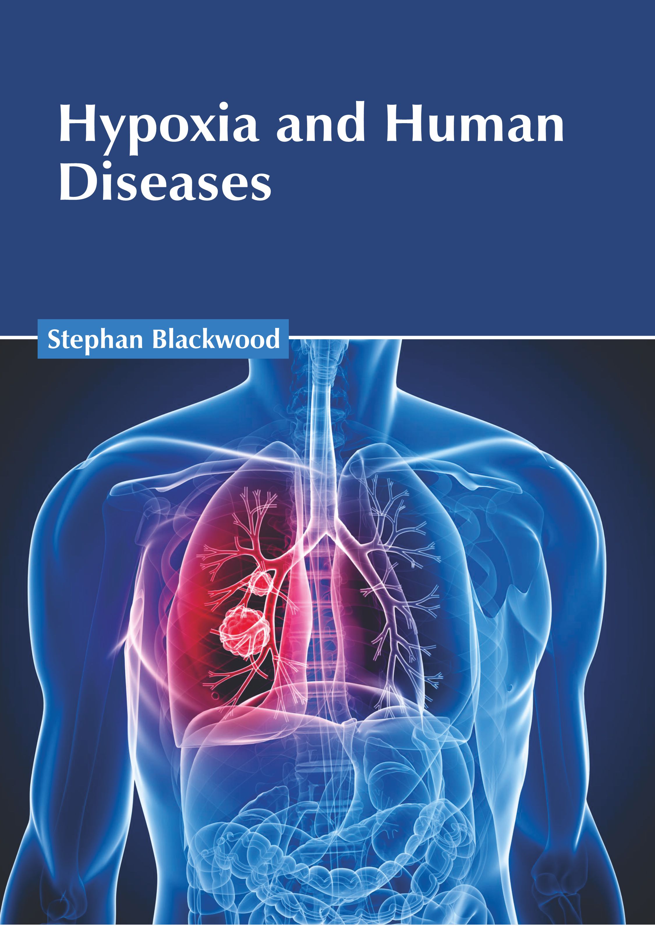 HYPOXIA AND HUMAN DISEASES