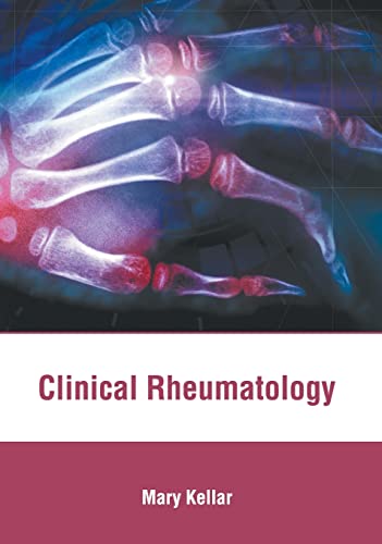 
exclusive-publishers/american-medical-publishers/clinical-rheumatology-9781639274741