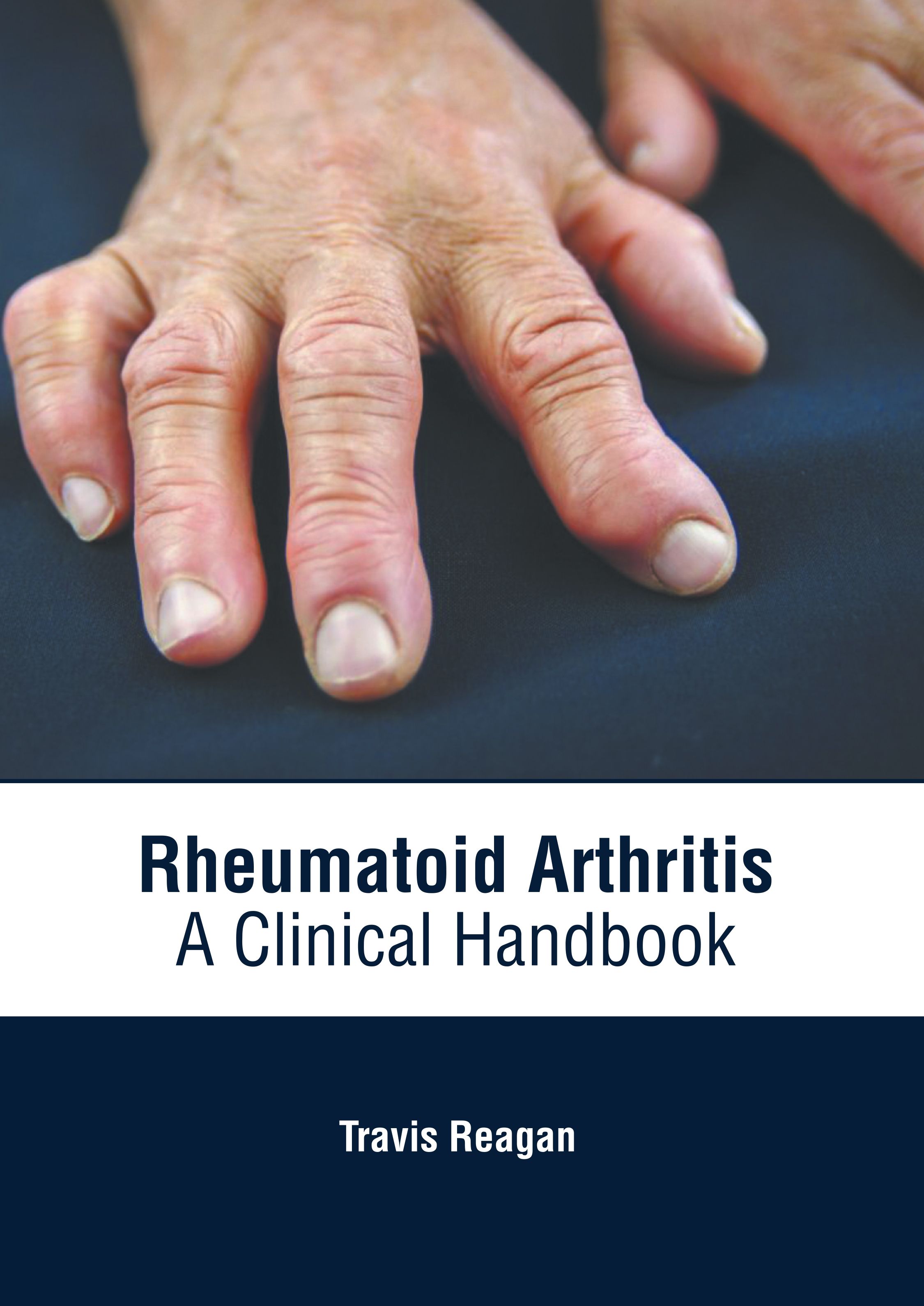 RHEUMATOID ARTHRITIS: A CLINICAL HANDBOOK- ISBN: 9781639274758