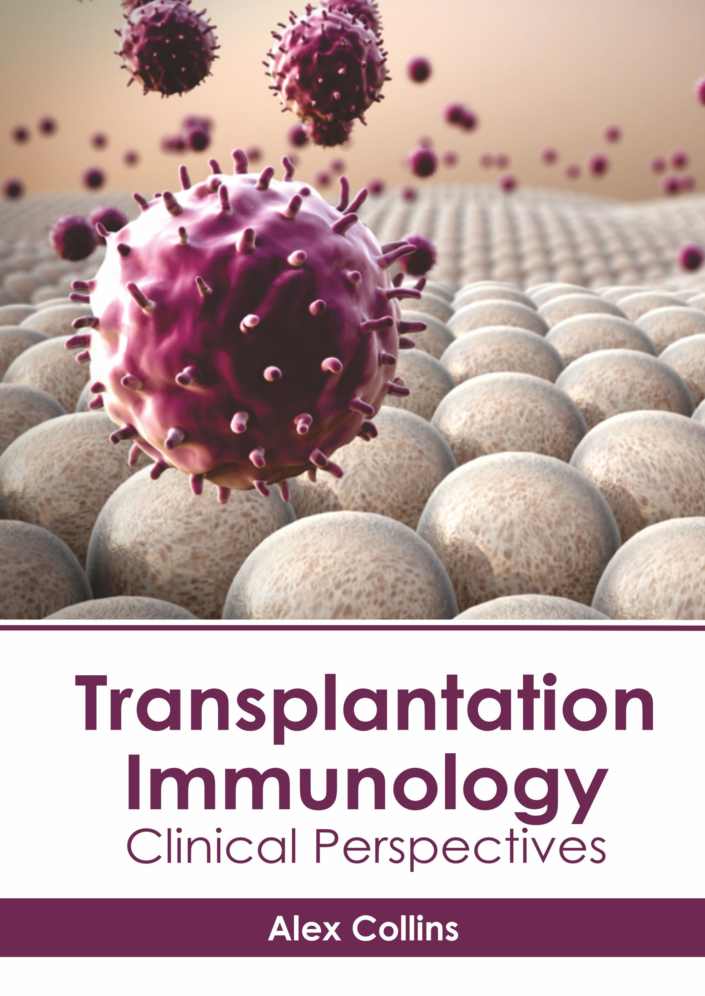 TRANSPLANTATION IMMUNOLOGY: CLINICAL PERSPECTIVES- ISBN: 9781639275021