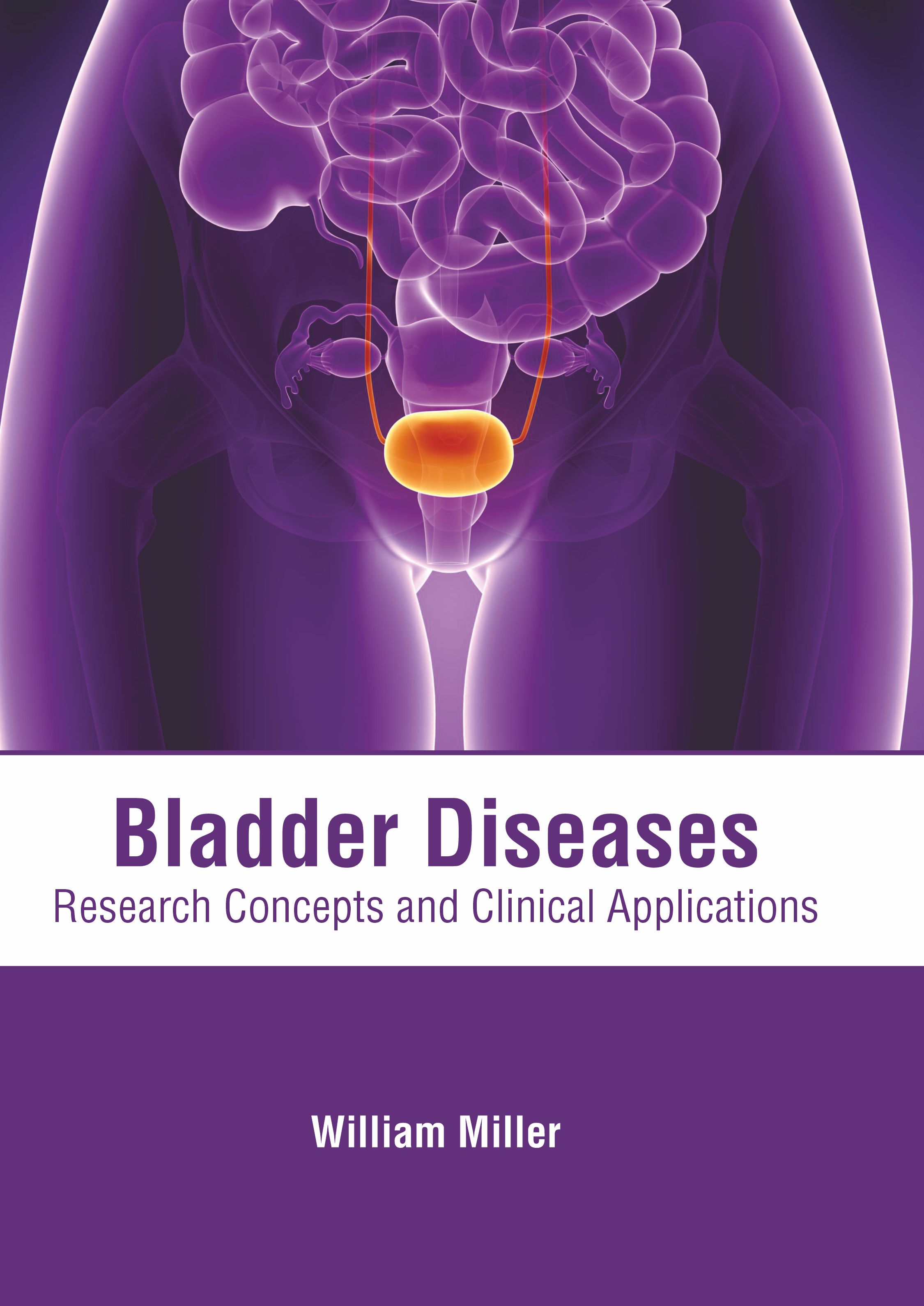 
exclusive-publishers/american-medical-publishers/bladder-diseases-research-concepts-and-clinical-applications-9781639275106