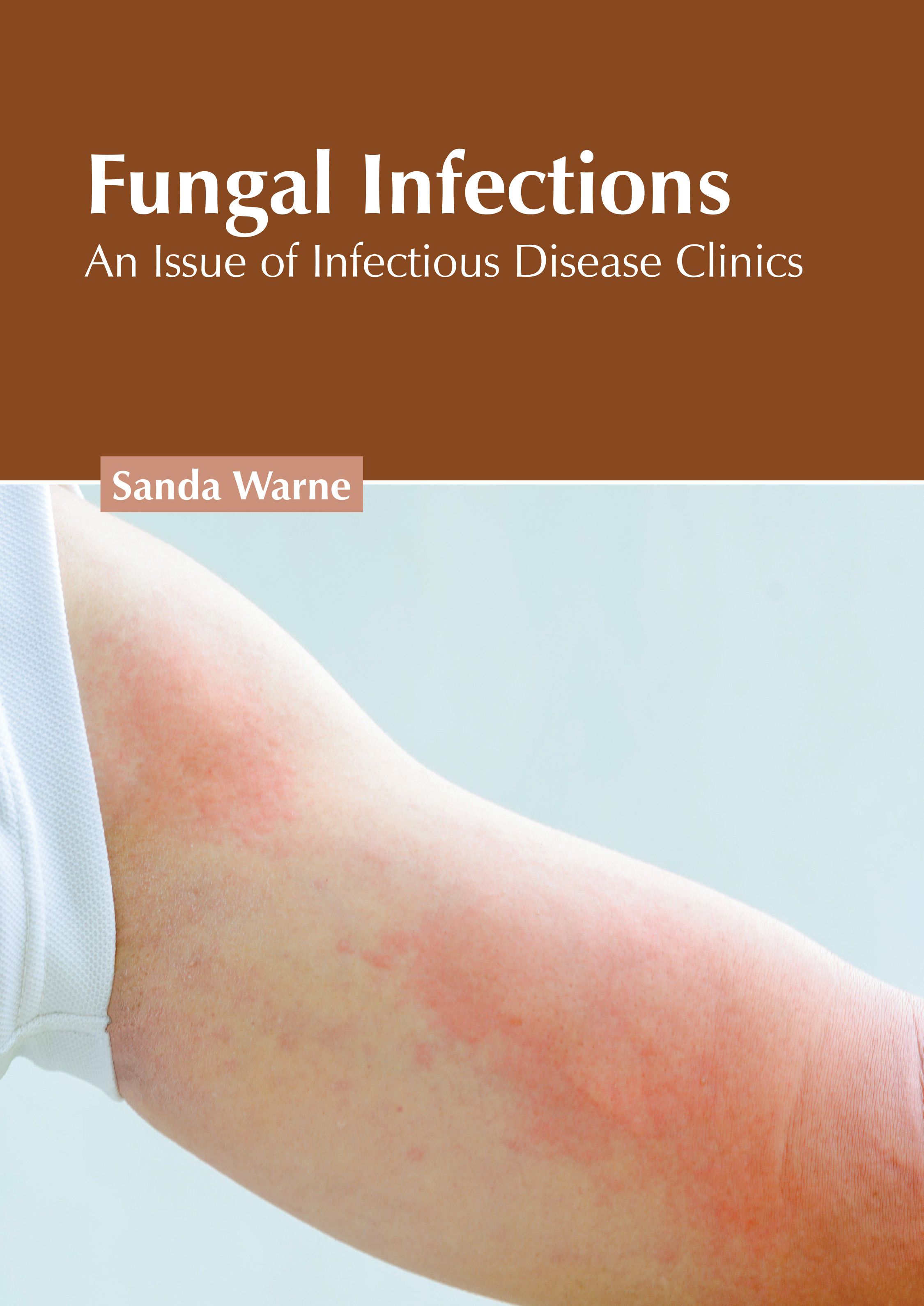 FUNGAL INFECTIONS: AN ISSUE OF INFECTIOUS DISEASE CLINICS