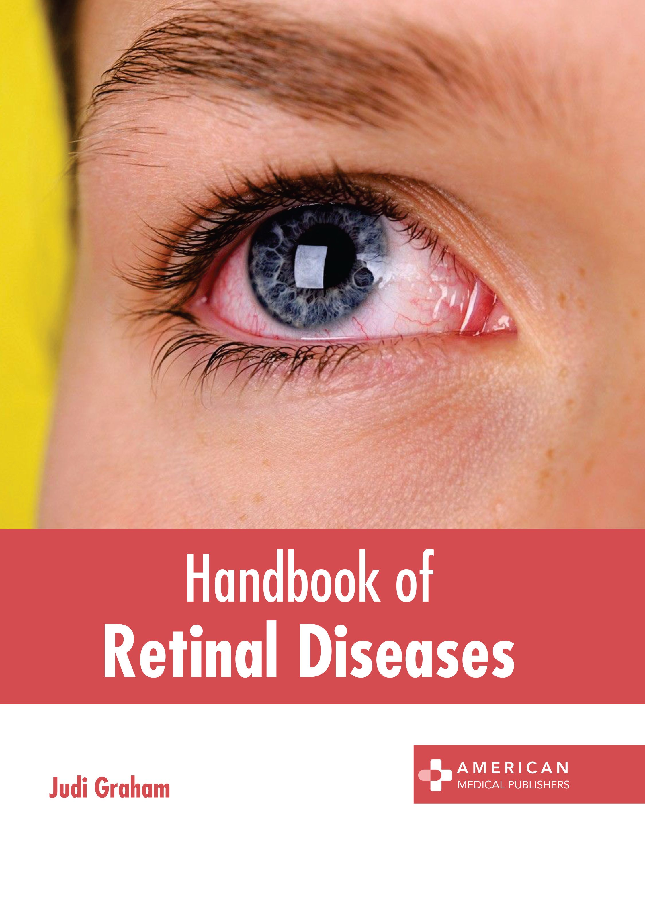 HANDBOOK OF RETINAL DISEASES
