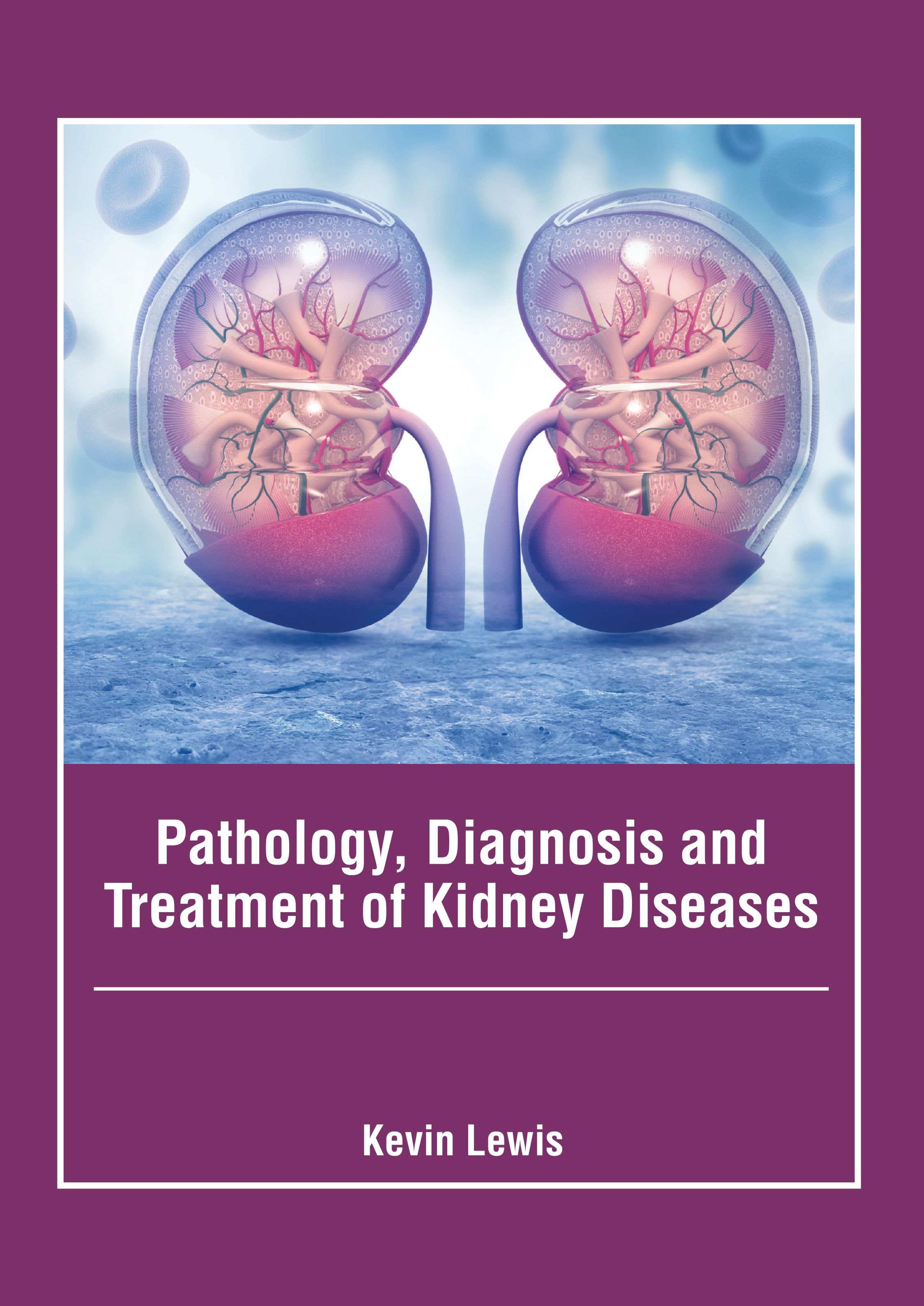 PATHOLOGY, DIAGNOSIS AND TREATMENT OF KIDNEY DISEASES