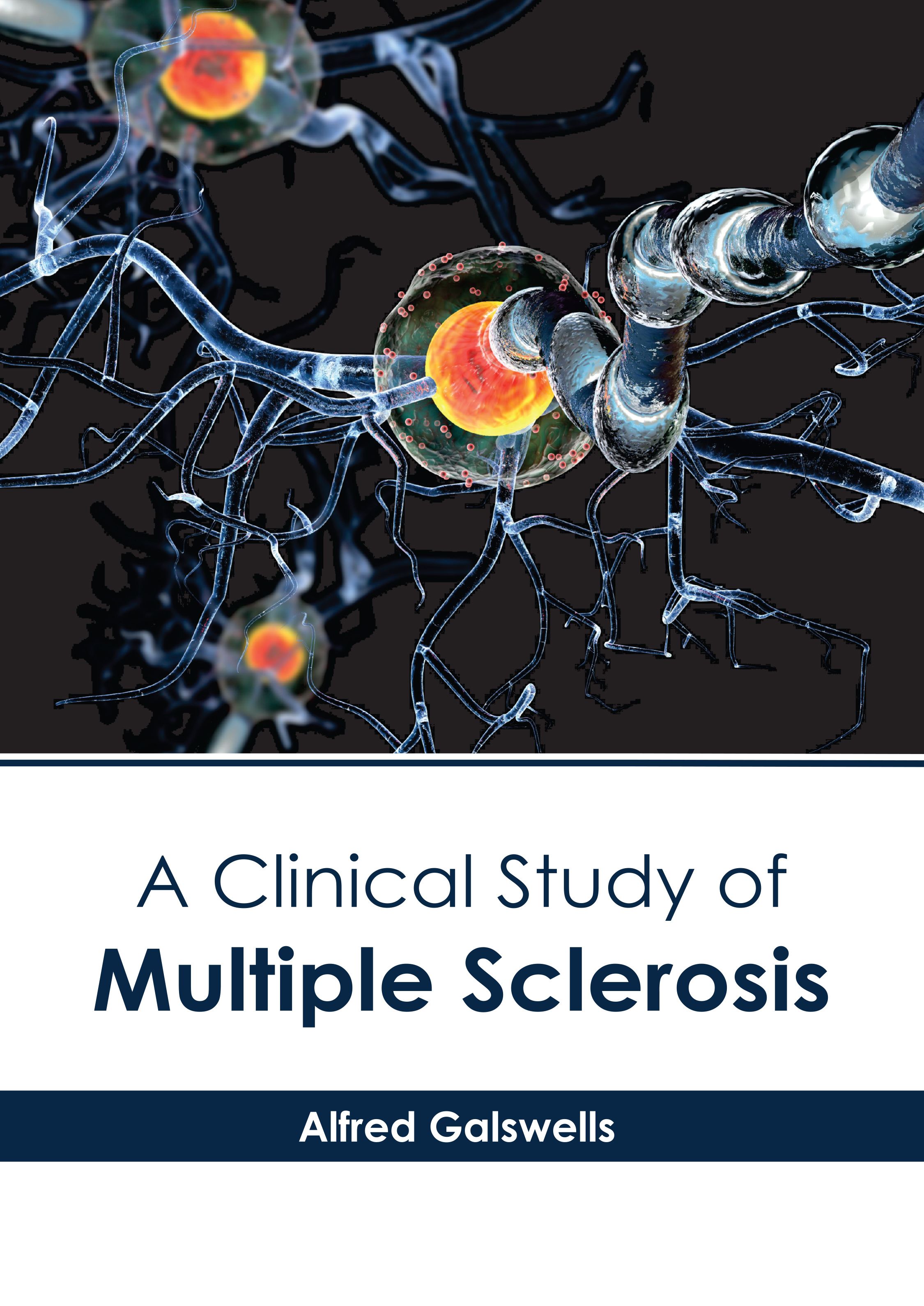 A CLINICAL STUDY OF MULTIPLE SCLEROSIS