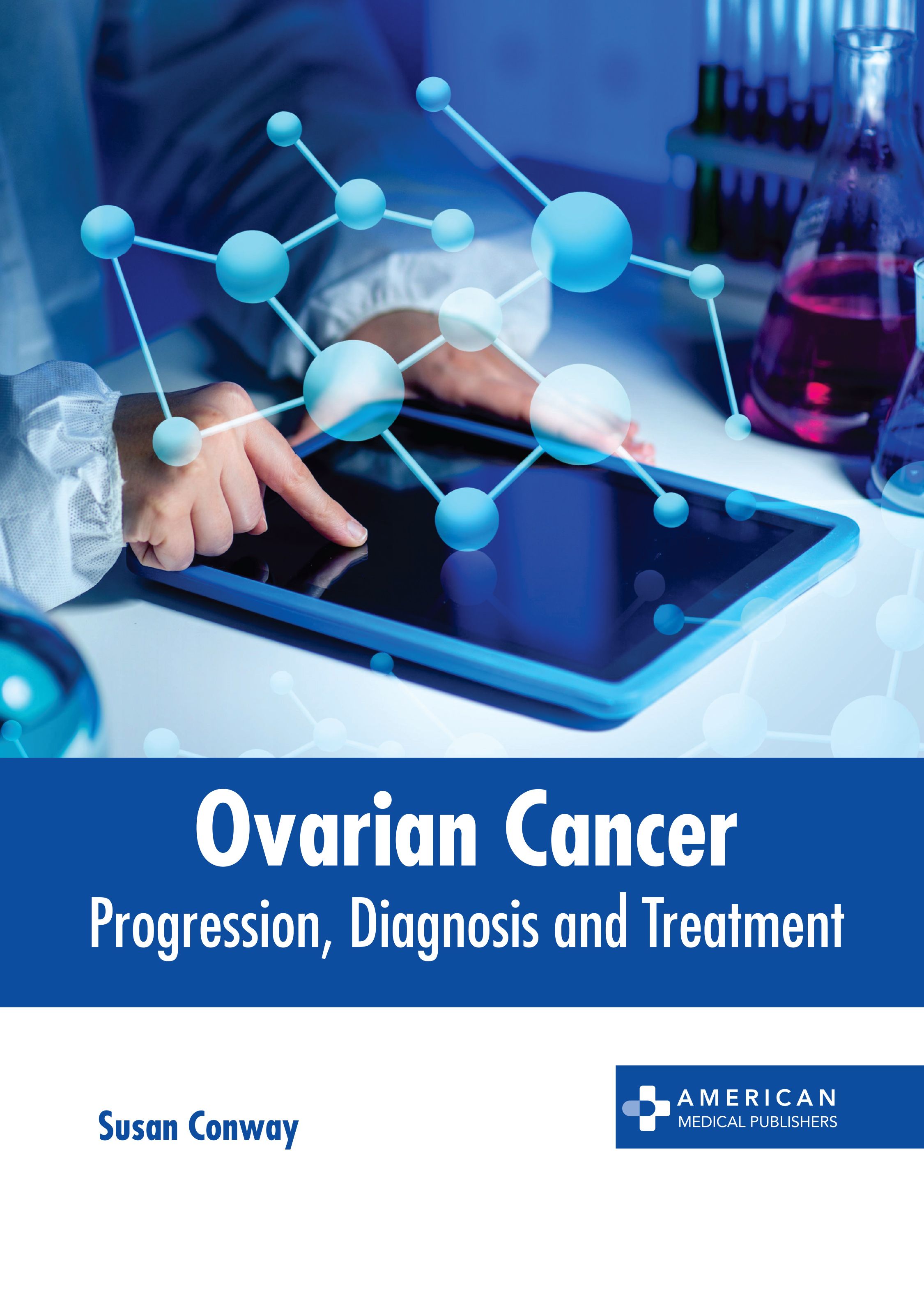 OVARIAN CANCER: PROGRESSION, DIAGNOSIS AND TREATMENT