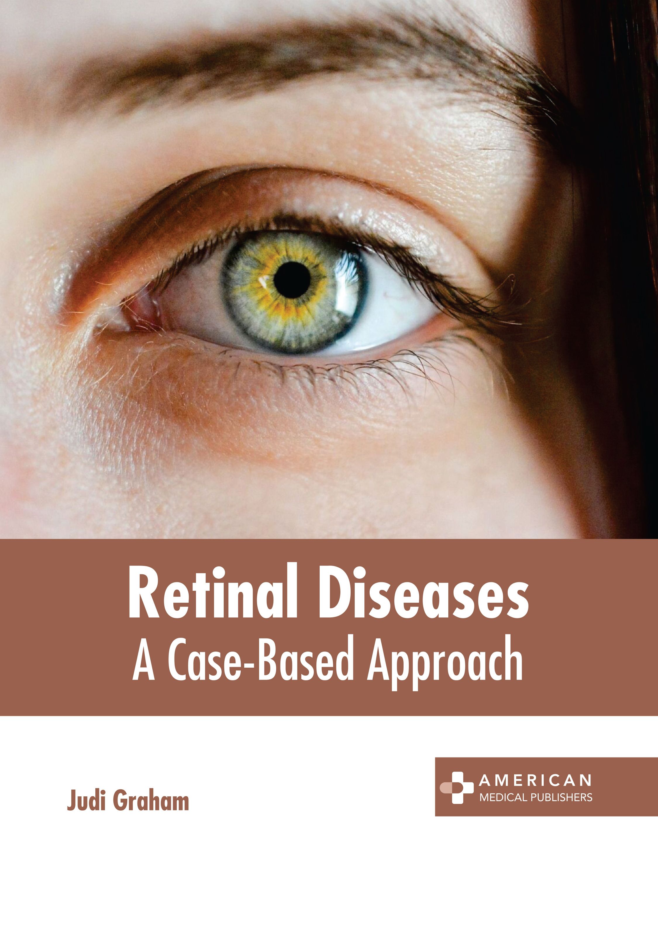RETINAL DISEASES: A CASE-BASED APPROACH