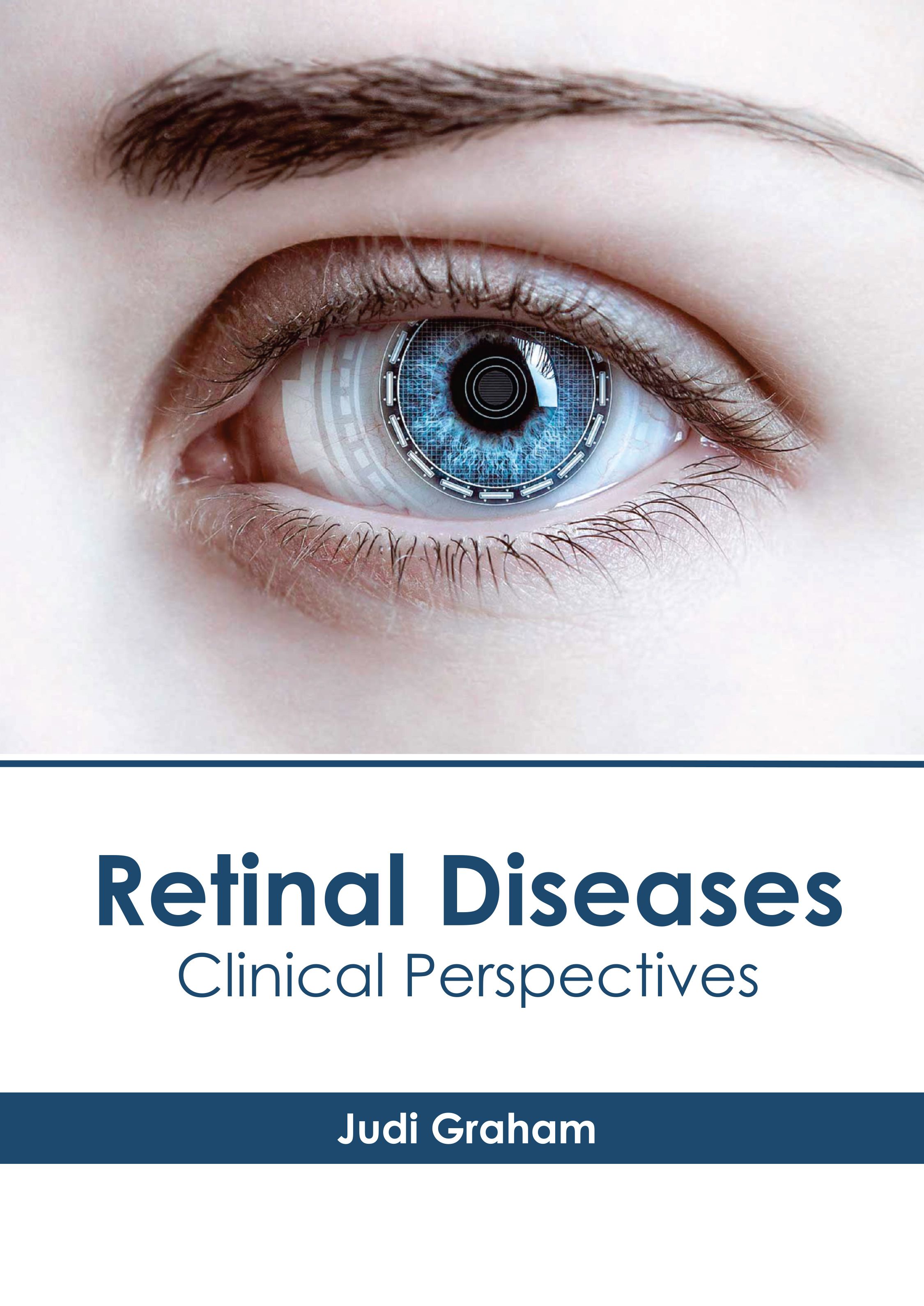 RETINAL DISEASES: CLINICAL PERSPECTIVES