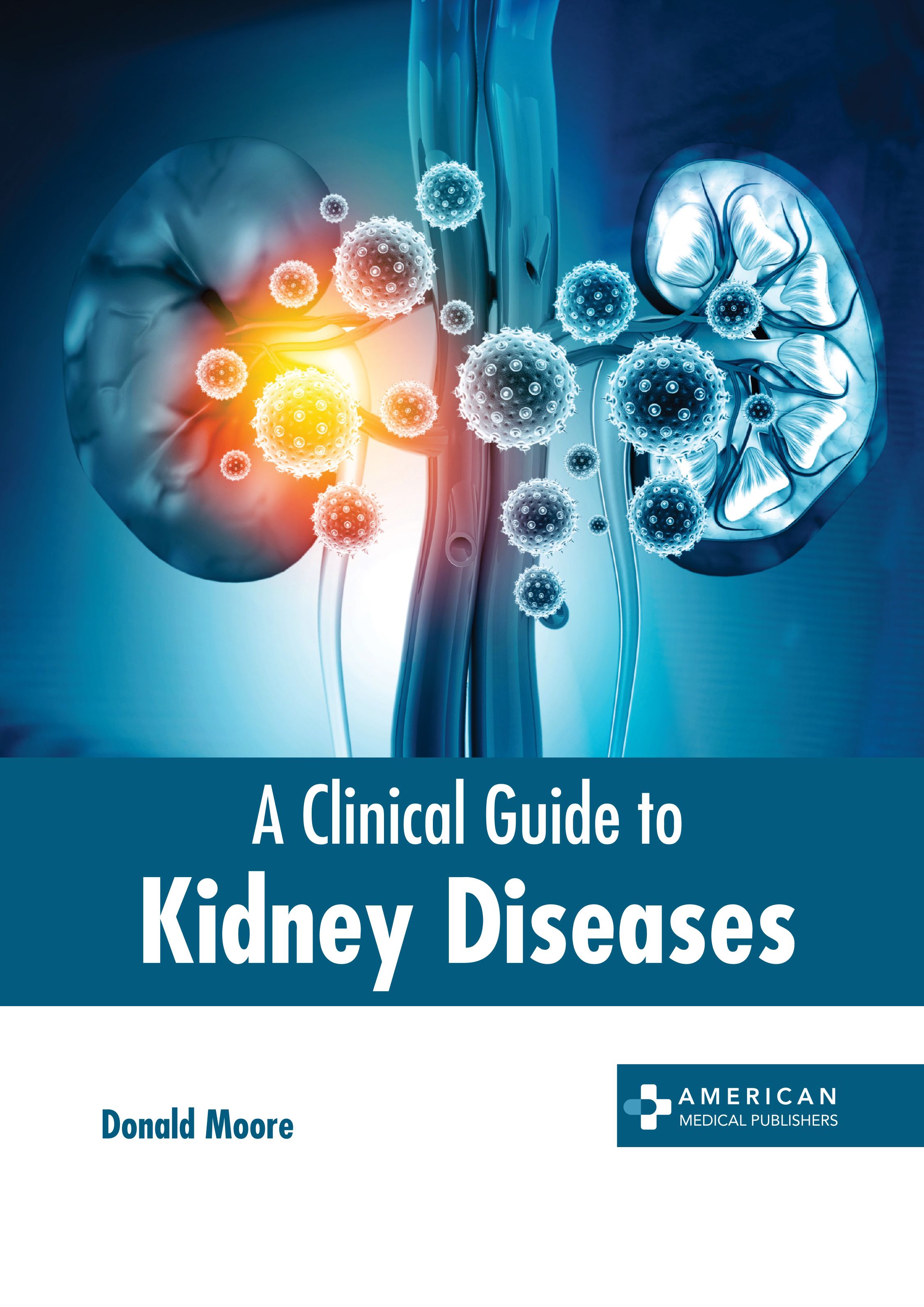 A CLINICAL GUIDE TO KIDNEY DISEASES