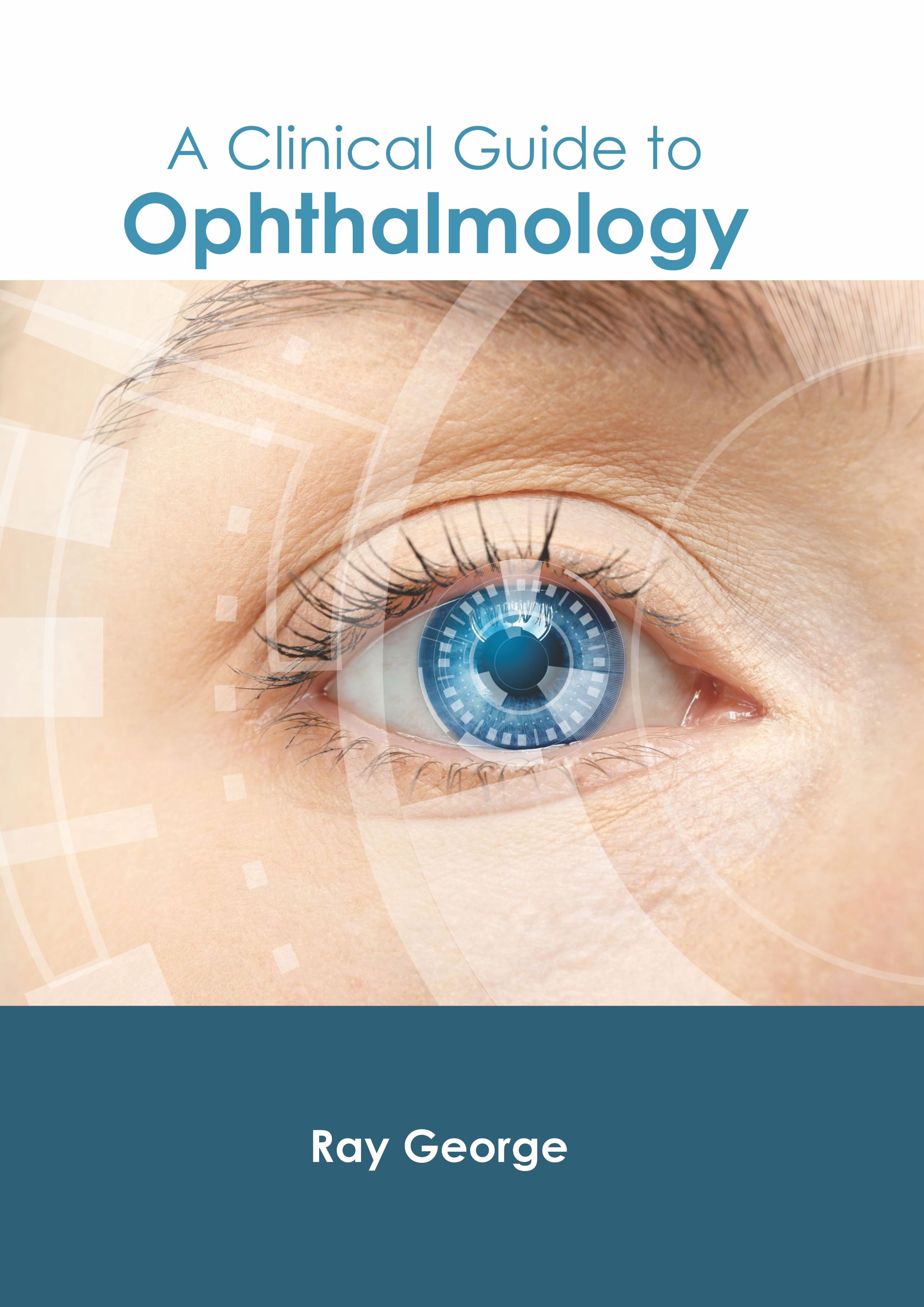 A CLINICAL GUIDE TO OPHTHALMOLOGY
