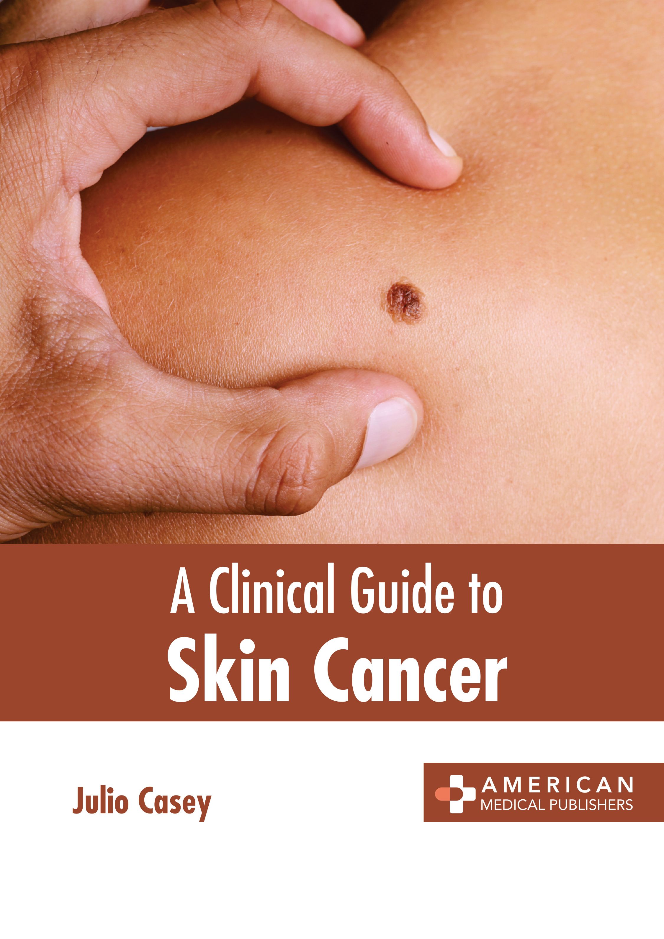 A CLINICAL GUIDE TO SKIN CANCER