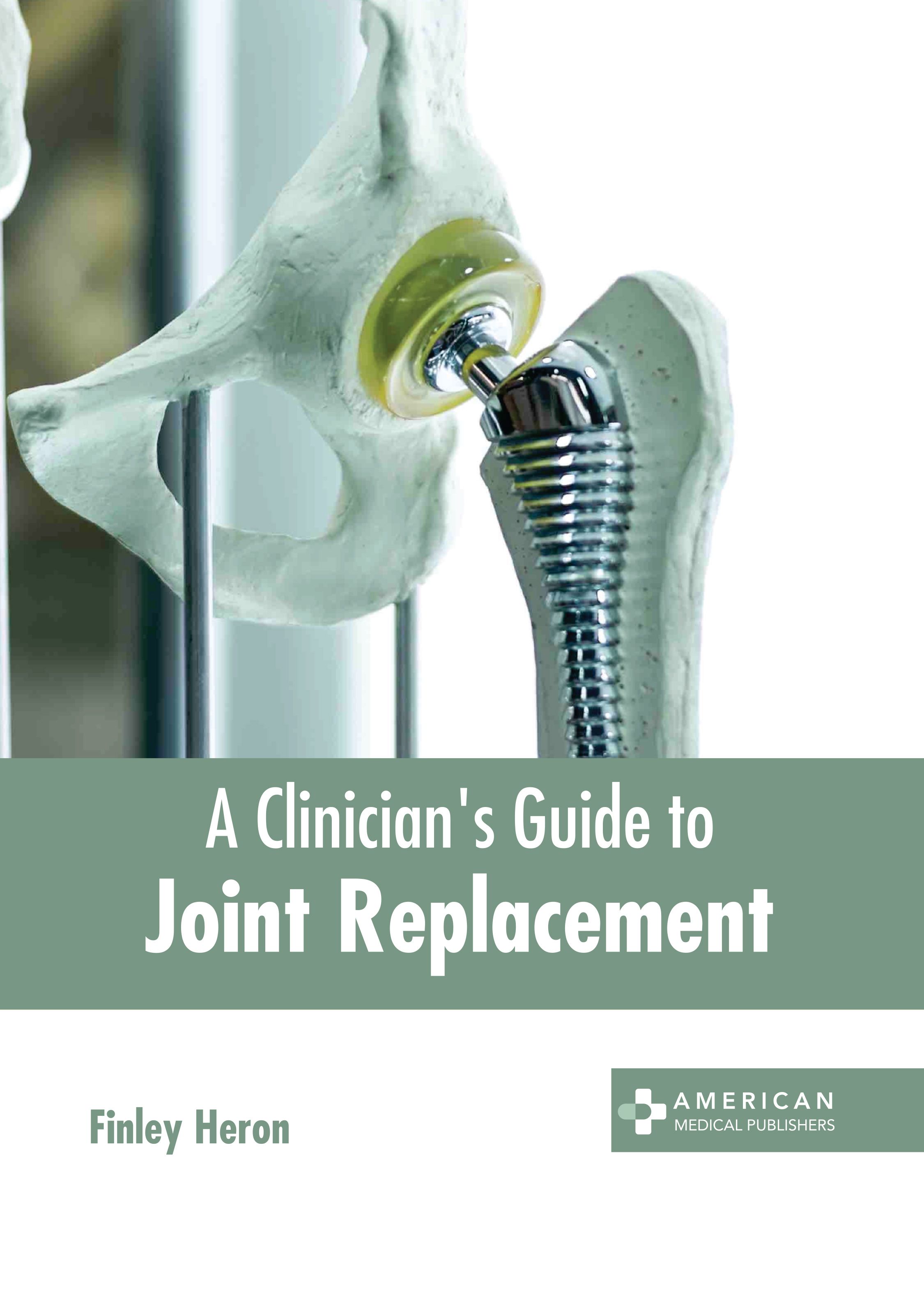 A CLINICIAN'S GUIDE TO JOINT REPLACEMENT