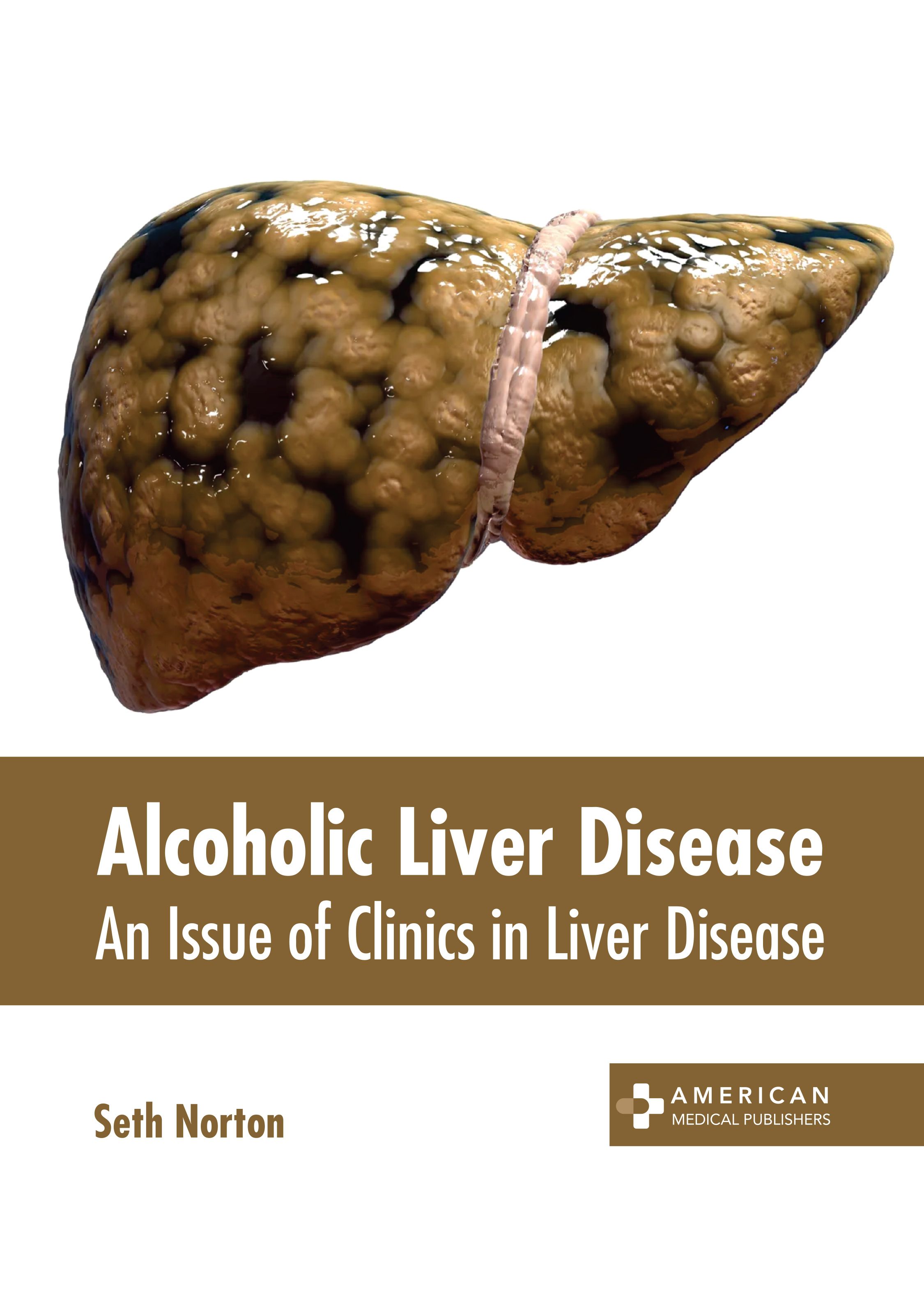 ALCOHOLIC LIVER DISEASE: AN ISSUE OF CLINICS IN LIVER DISEASE