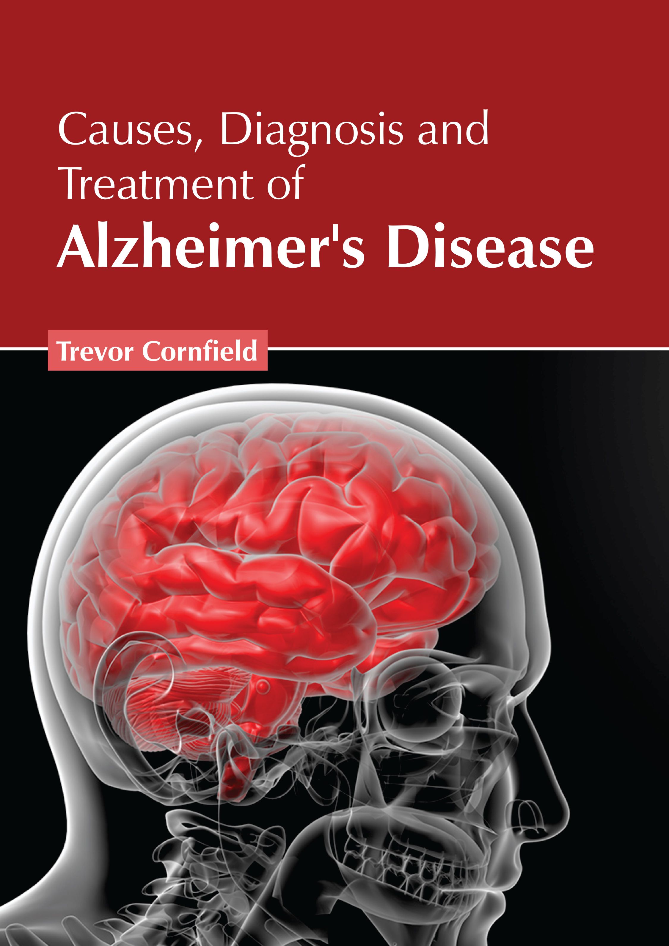 CAUSES, DIAGNOSIS AND TREATMENT OF ALZHEIMER'S DISEASE
