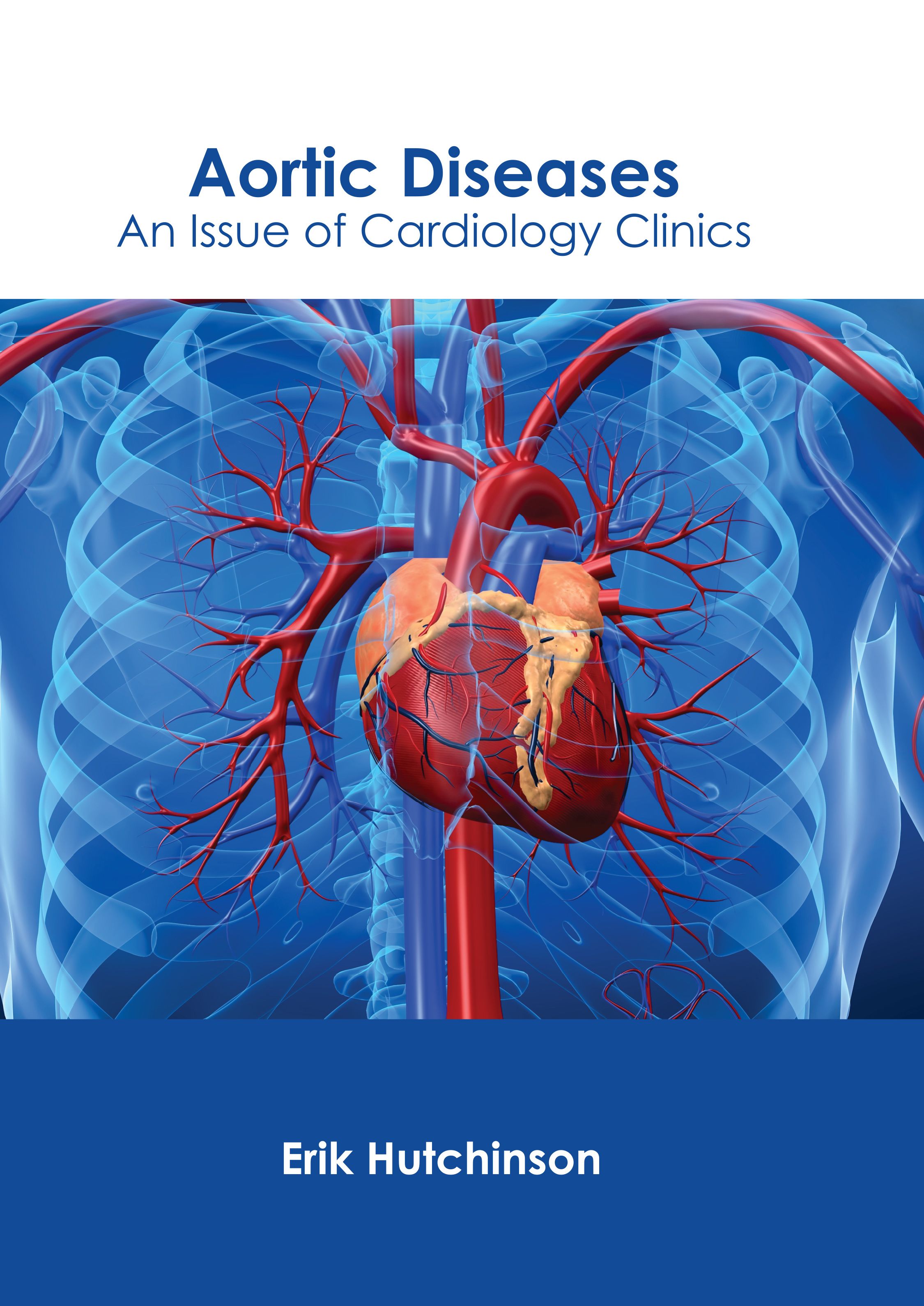 AORTIC DISEASES: AN ISSUE OF CARDIOLOGY CLINICS