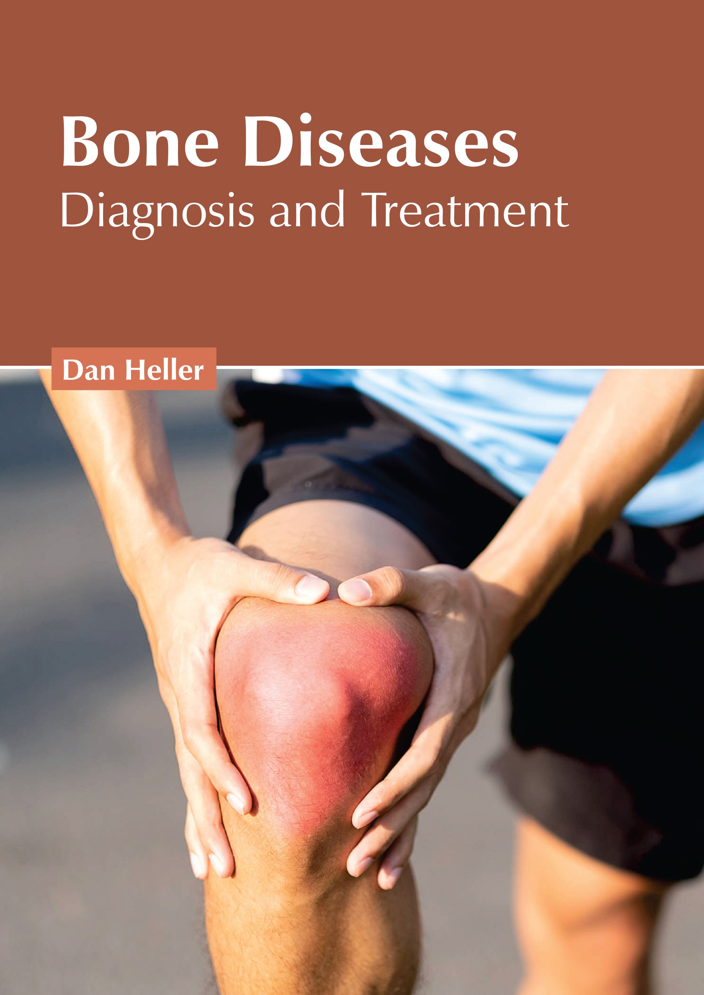 BONE DISEASES: DIAGNOSIS AND TREATMENT