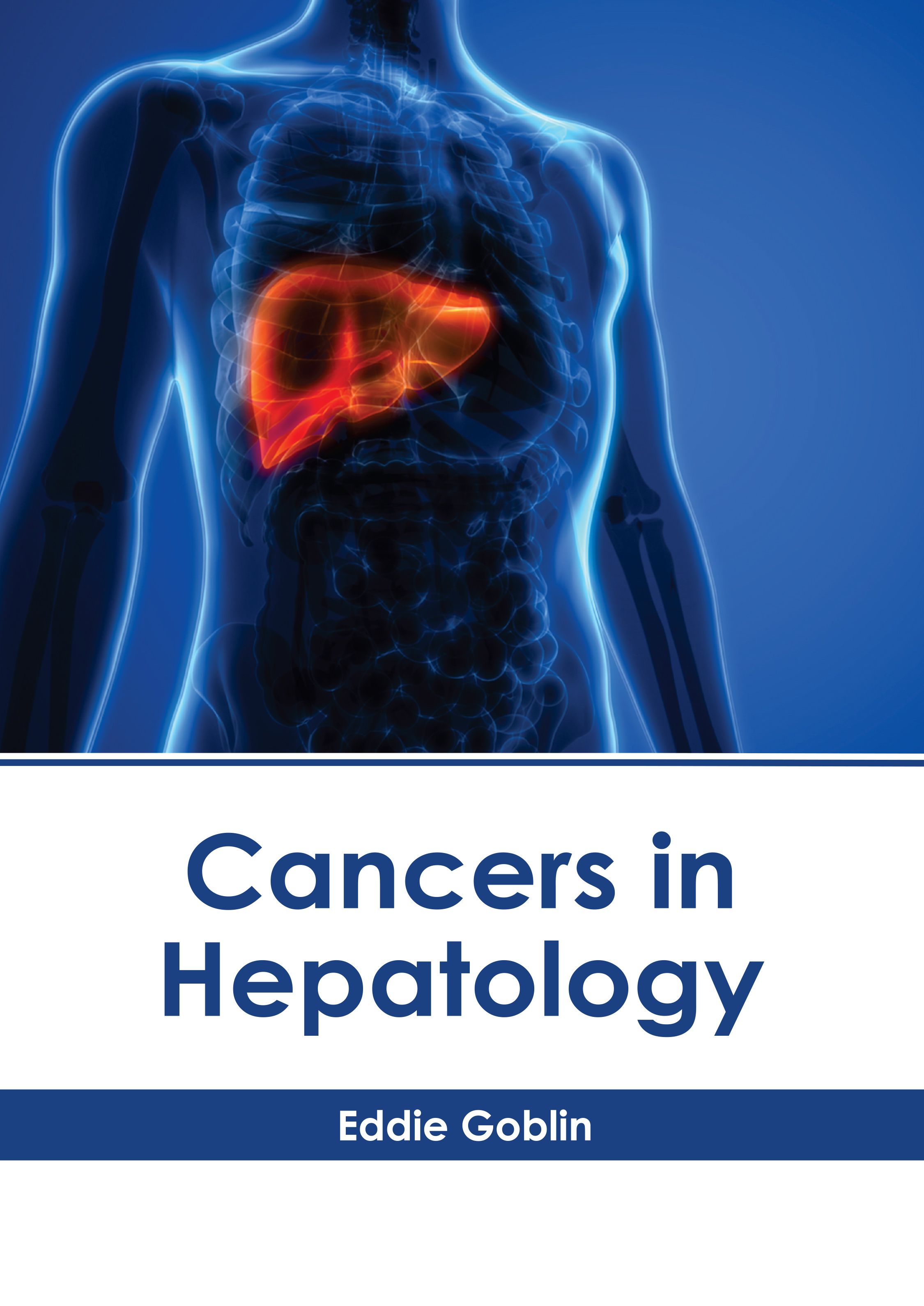 CANCERS IN HEPATOLOGY