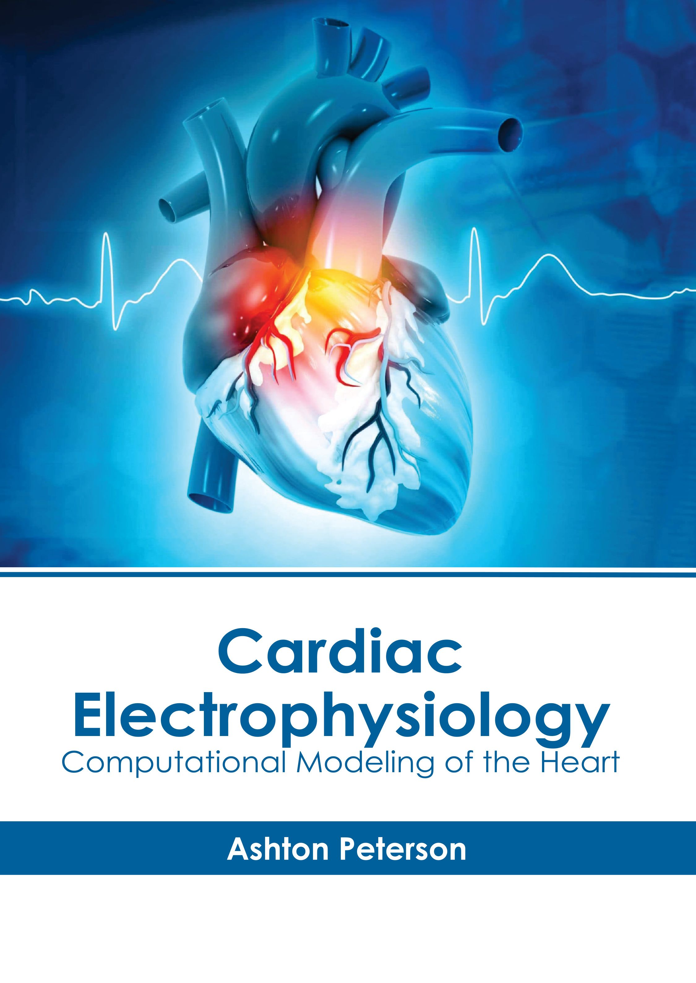 CARDIAC ELECTROPHYSIOLOGY: COMPUTATIONAL MODELING OF THE HEART