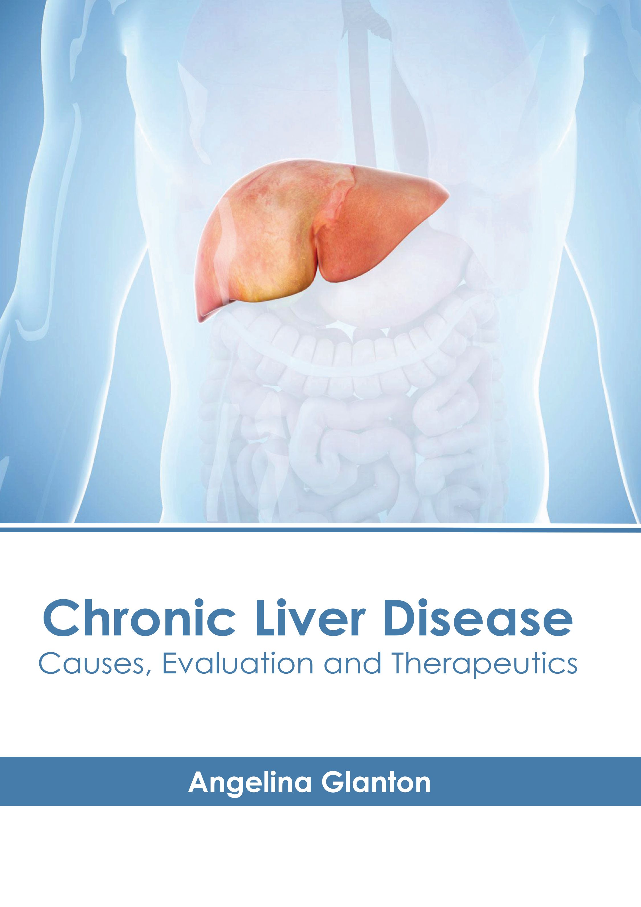 CHRONIC LIVER DISEASE: CAUSES, EVALUATION AND THERAPEUTICS