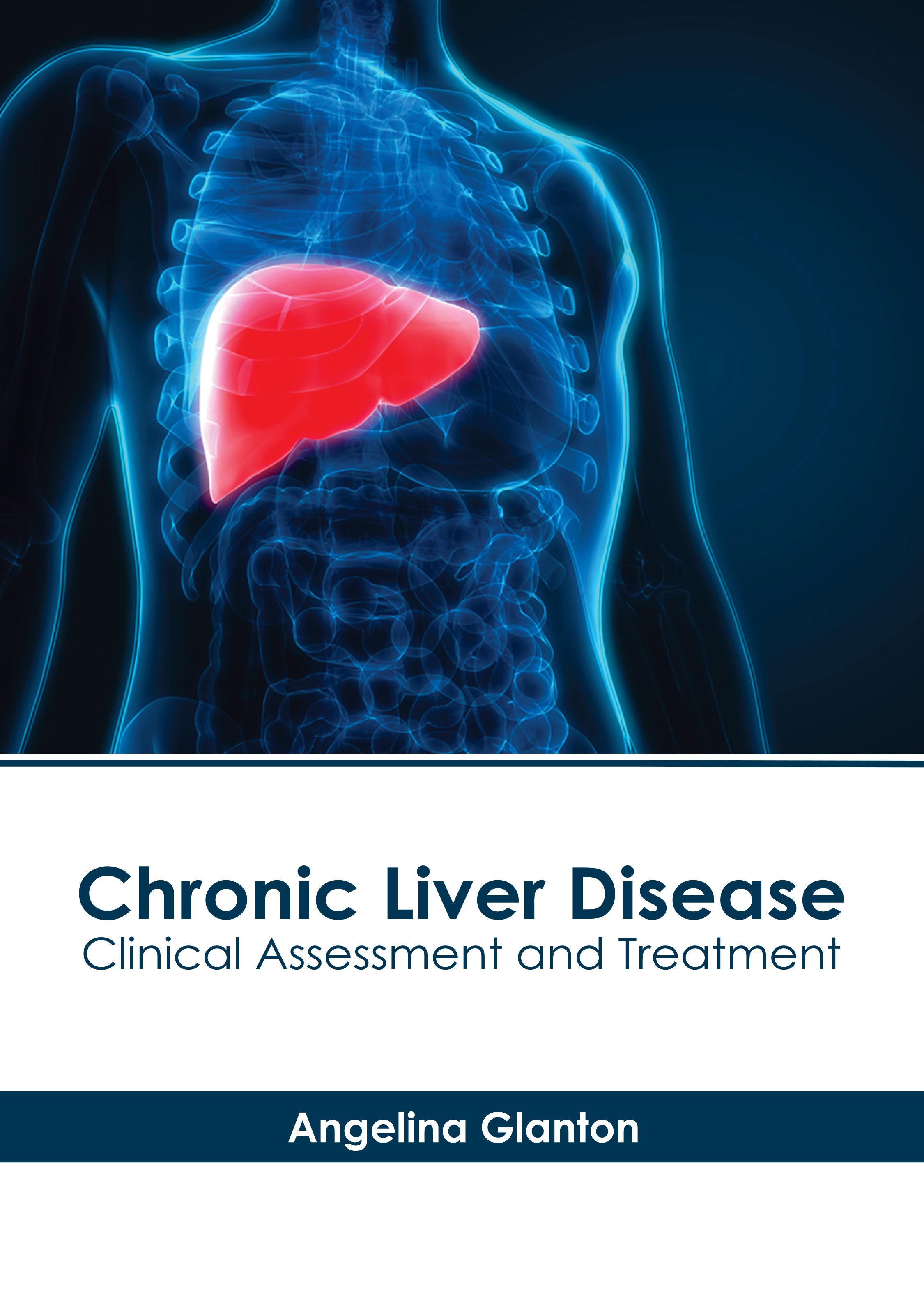 CHRONIC LIVER DISEASE: CLINICAL ASSESSMENT AND TREATMENT