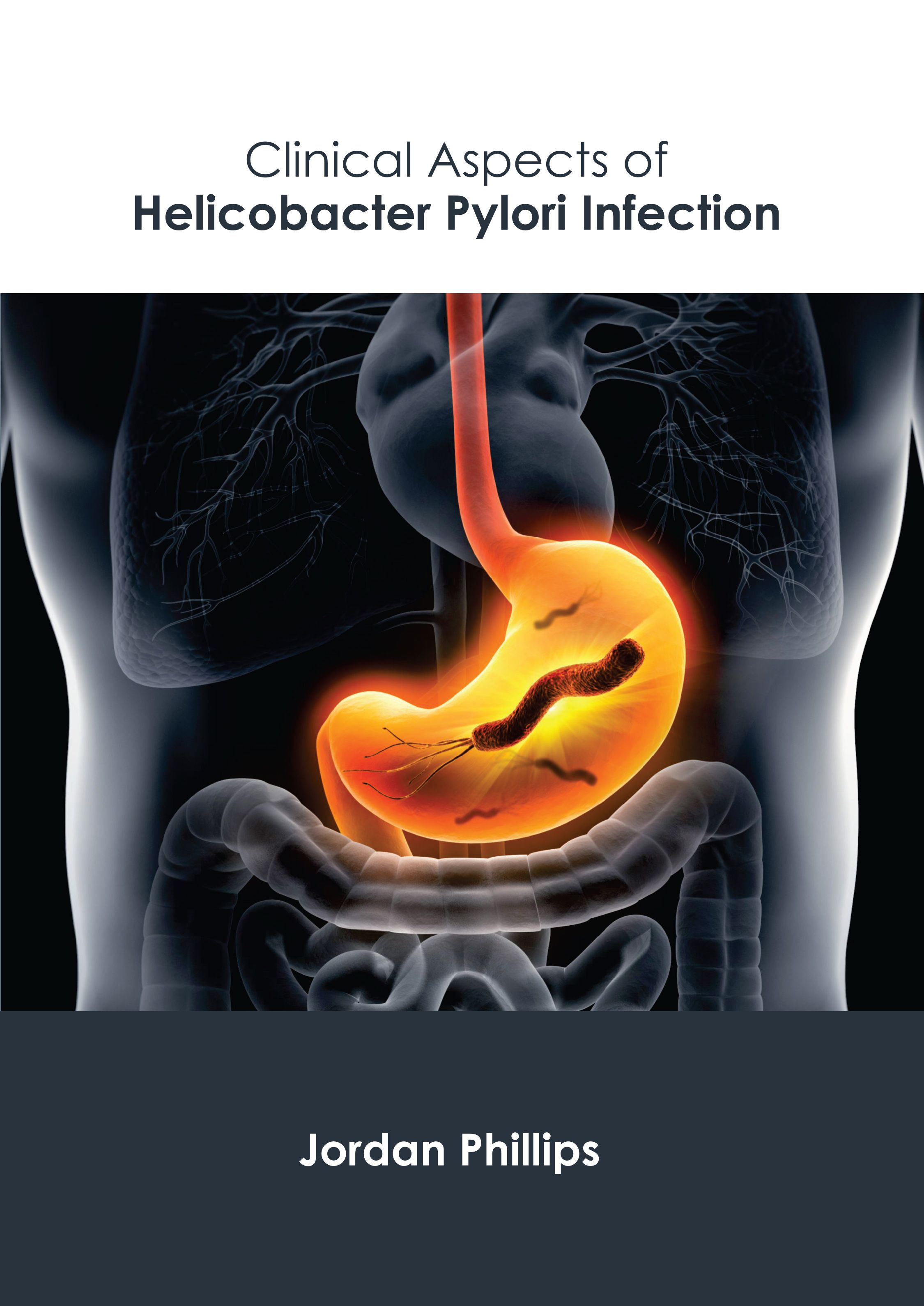 CLINICAL ASPECTS OF HELICOBACTER PYLORI INFECTION