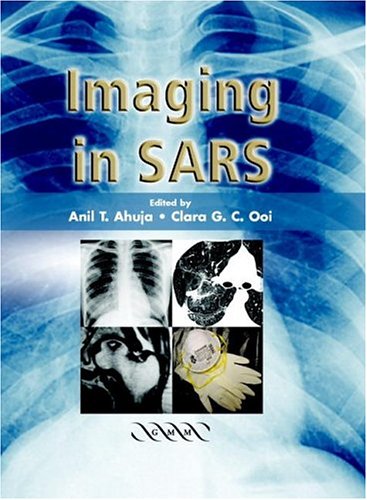 
imaging-in-sars--9781841102191