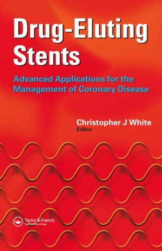 basic-sciences/pharmacology/drug-eluting-stents-advanced-applications-for-the-management-of-coronary-disease-9781842143032