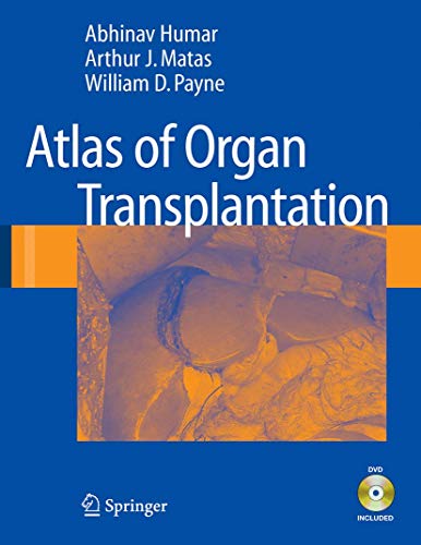 
surgical-sciences/surgery/atlas-of-organ-transplantation--9781846283147