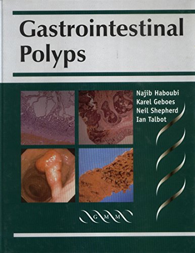 
gastrointesinal-poyps--9781900151214