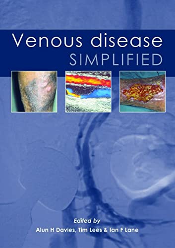 general-books/general/venous-disease-simplified--9781903378250