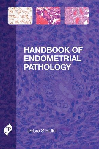 best-sellers/jaypee-brothers-medical-publishers/handbook-of-endometrial-pathology-9781907816109