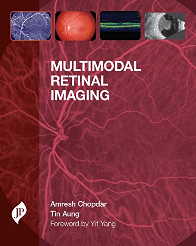 
best-sellers/jaypee-brothers-medical-publishers/multimodal-retinal-imaging-9781907816604