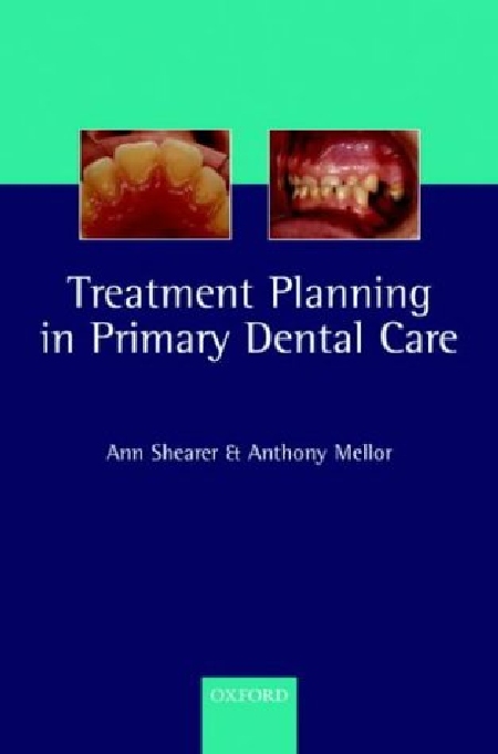 TREATMENT PLANNING IN PRIMARY DENTAL CARE