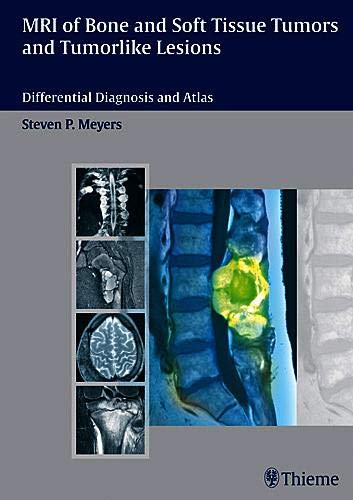 
mri-of-bone-and-soft-tissue-tumors-and-tumorlike-lesions-differential-diagnosis-and-atlas-1-e--9783131354211