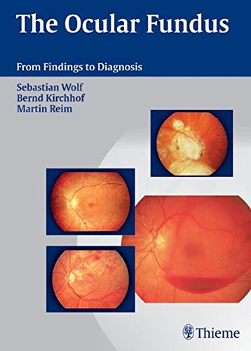 
the-ocular-fundus-from-findings-to-diagnosis-1-e--9783131393715