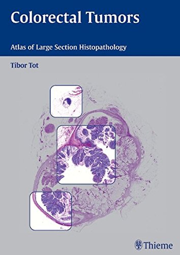 
colorectal-tumors-atlas-of-large-section-histopathology-1-e--9783131405913