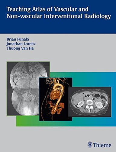 
teaching-atlas-of-vascular-and-nonvascular-interventional-radiology--9783131441812