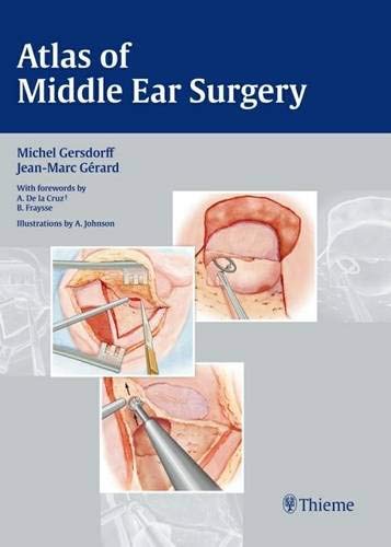 
atlas-of-middle-ear-surgery--9783131450418