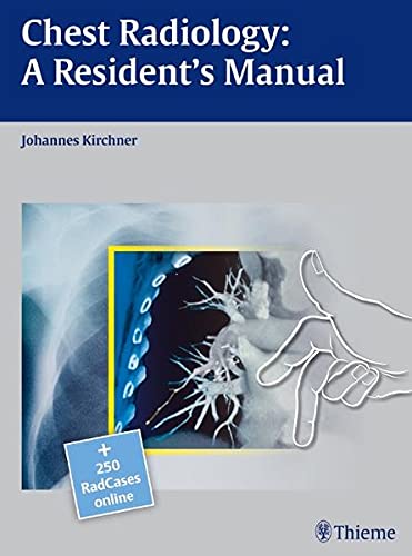 
chest-radiology-a-resident-s-manual-9783131538710