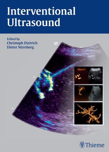 
interventional-ultrasound-a-practical-guide-and-atlas-1-e-9783131708212